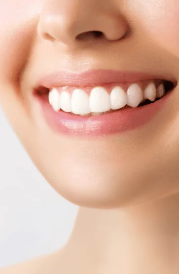Teeth Whitening page