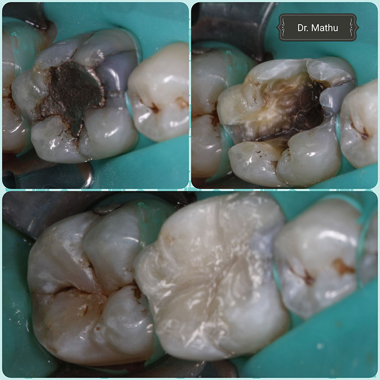 Dental Images